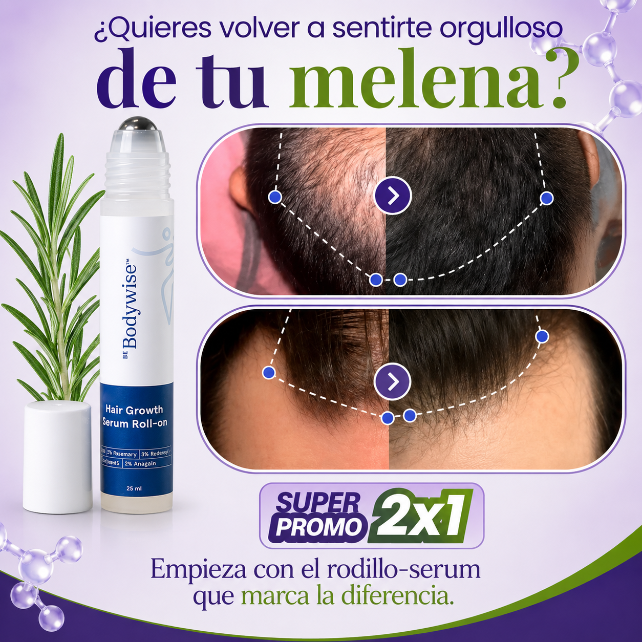 BodyWise Hair Growth - Sérum Capilar Anticaída y Crecimiento Intensivo